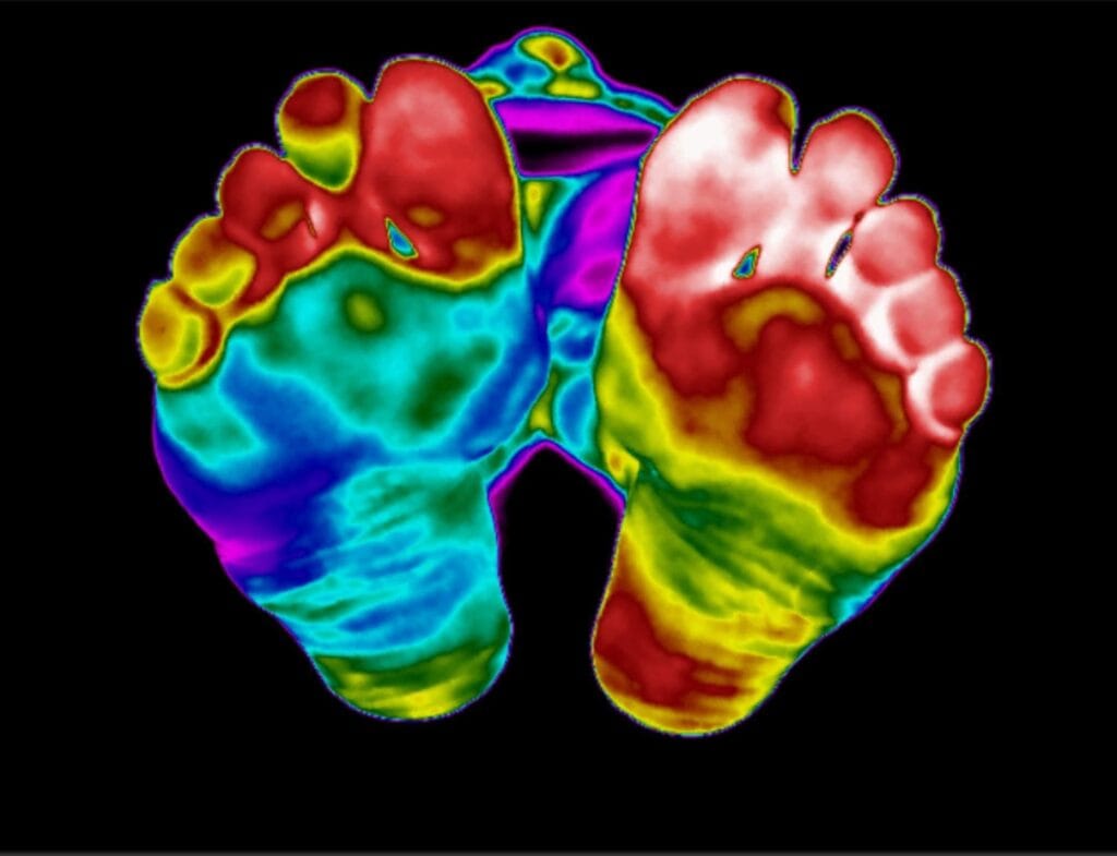Zdjęcie termografii medycznej - stopy